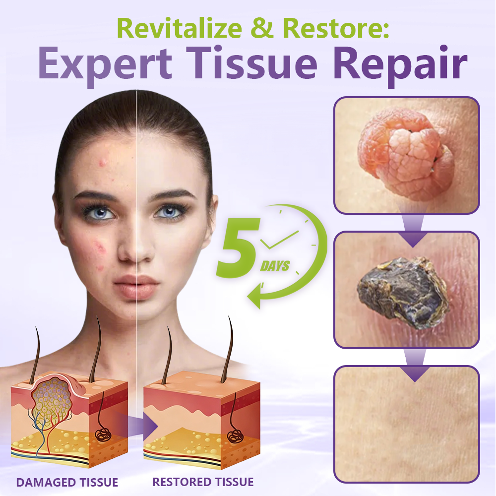SOLUBLE MICRONEEDLE BOTANICAL SKIN TAG REMOVAL PATCH