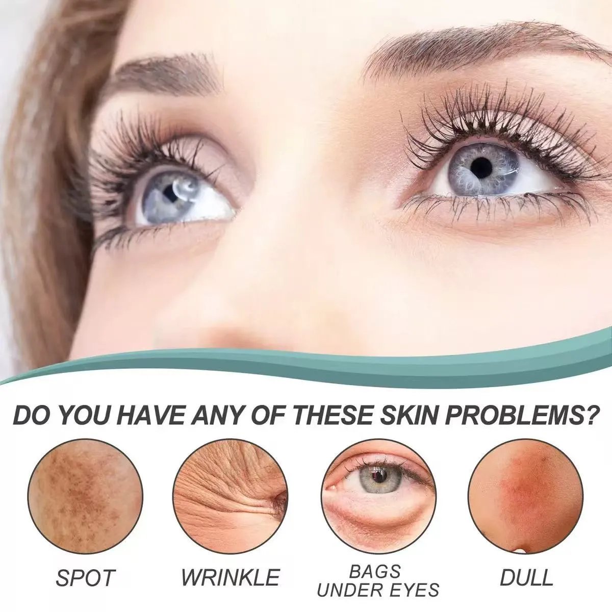 Dark Spot Corrector-Special Cream For Melasma Treatment