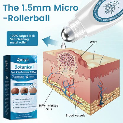 Zyreytt® Botanical Spot & Tag Precision RollPen