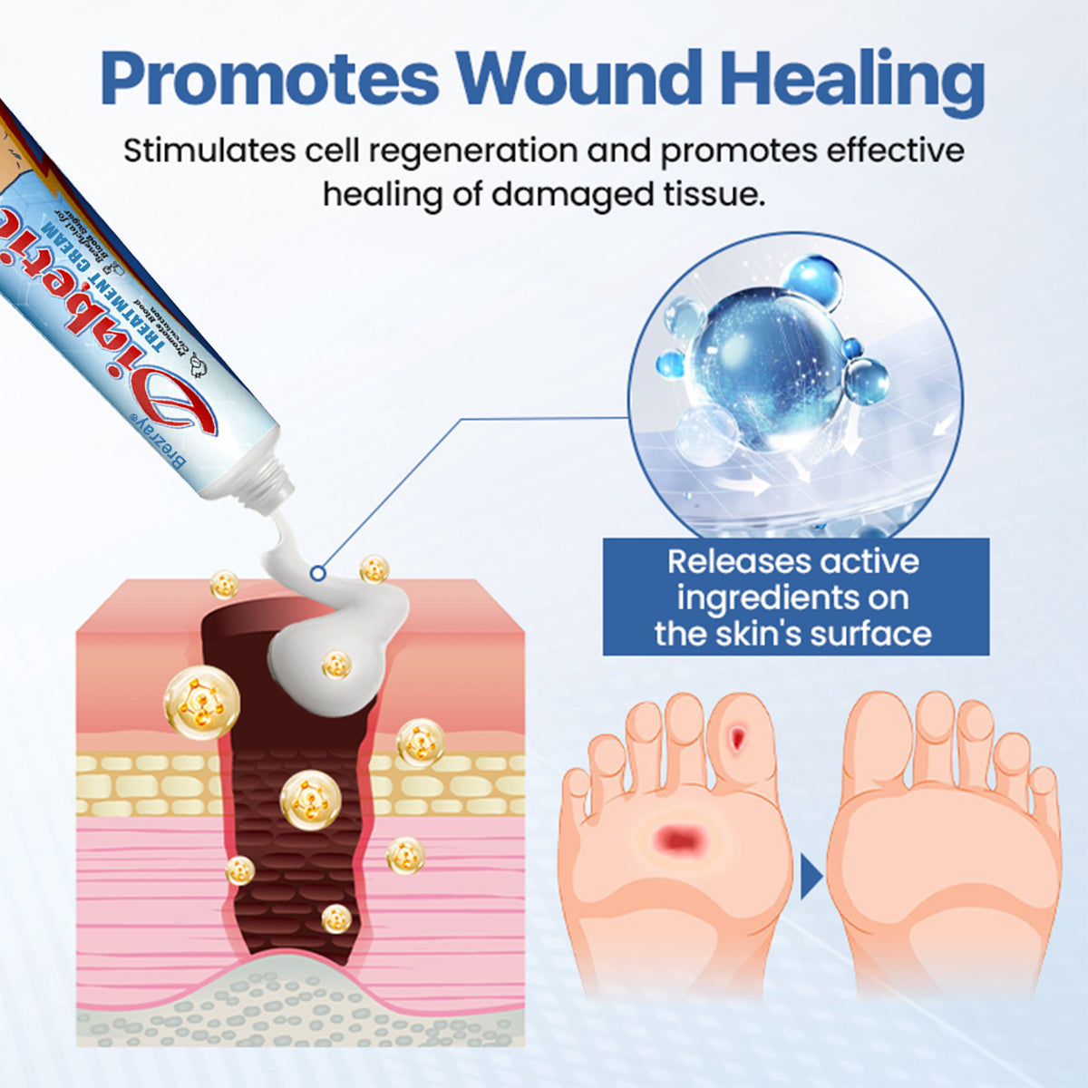 🔥70% OFF Today Only!⏰ Brezray® VitaGluco Diabetes Treatment Cream – Limited Stock!