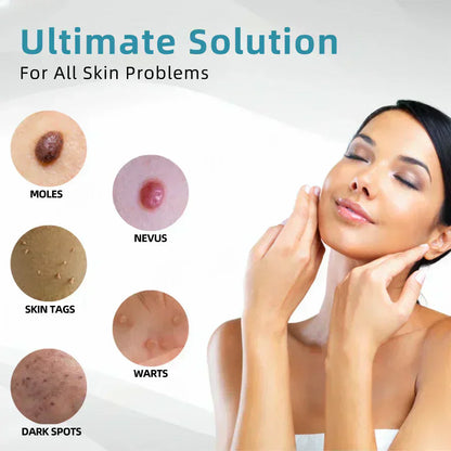 💞in-One CO₂ Laser Eraser Pen | Removes Moles, Warts, Skin Flaws & Pigmentation