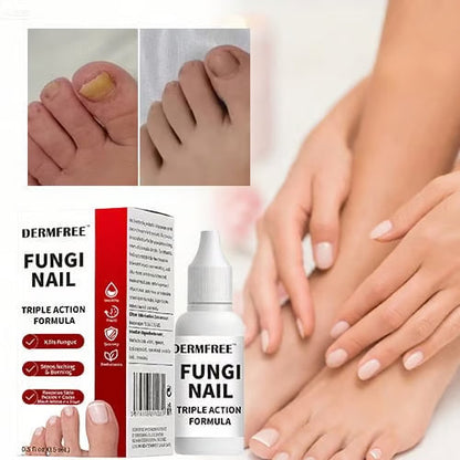 Toenail Fungus Treatment Extra Strengthr