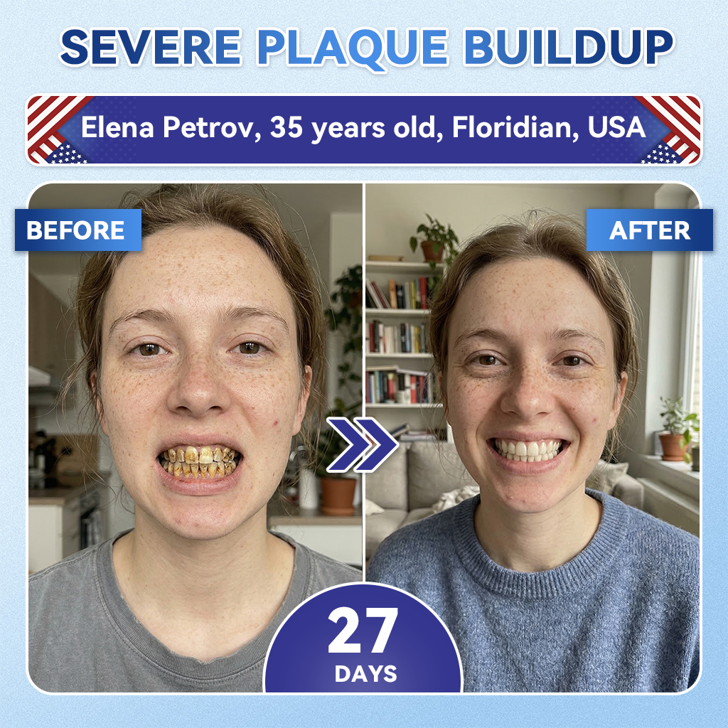 Alisanda® 🦷 Tideglusib Fast‑Dissolving Tooth & Gum Repair Oral Strips ✨