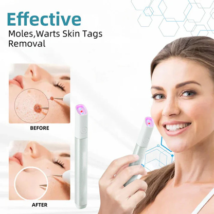 💞in-One CO₂ Laser Eraser Pen | Removes Moles, Warts, Skin Flaws & Pigmentation