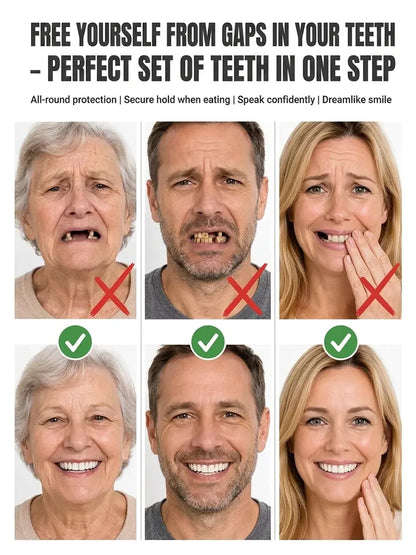 🎁Ends Today: 70% OFF! 🦷Advanced Customized Full Denture Set🦷 (🔥10,000+ Sold In Last 30 Day)
