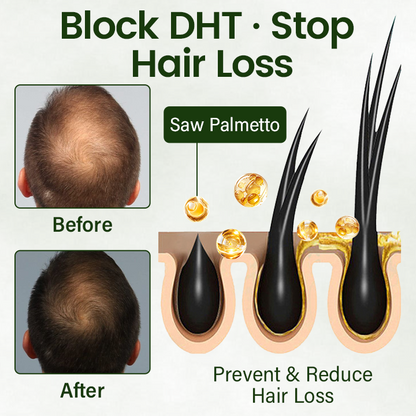 Lovilds® Hair Restoration Spray ( Reawaken Your Roots. Regrow Naturally. ✨ Clinically Proven Hair Regrowth Within 4 Weeks ✨)