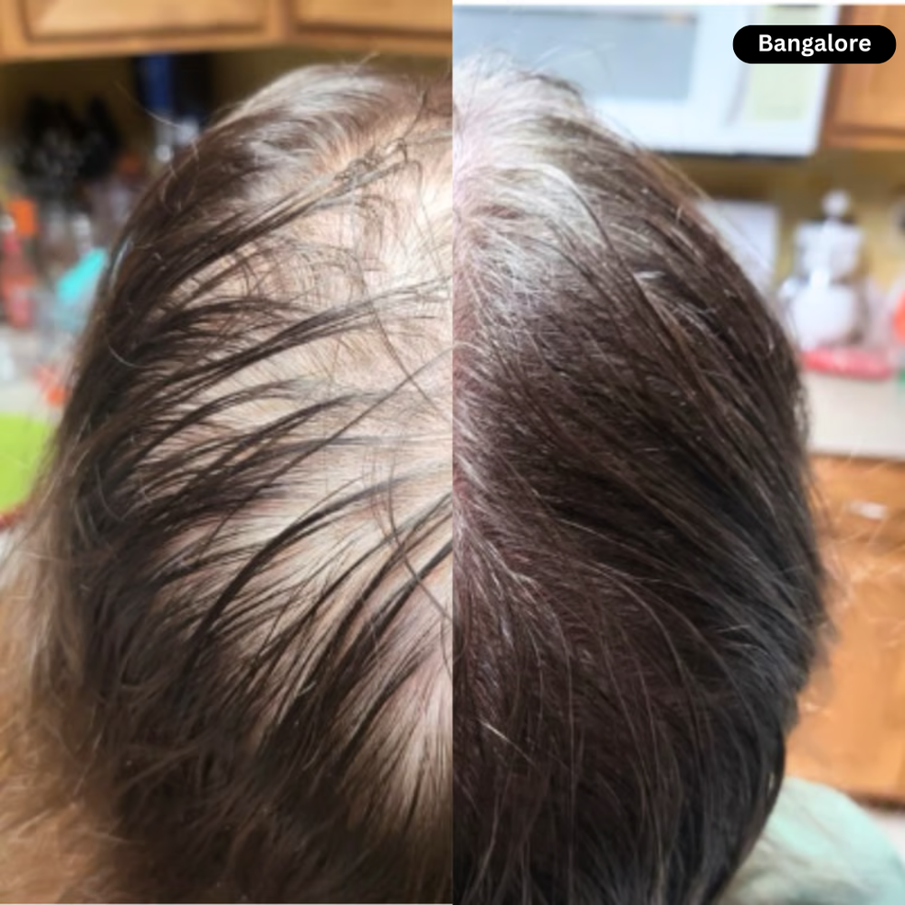 Rovinao hair transformation