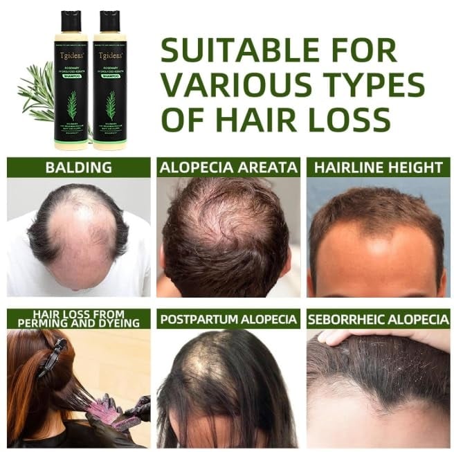Tgideas Organic Rosemary Hair Growth Shampoo