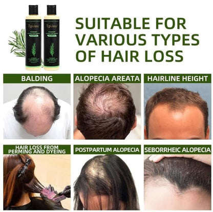 Tgideas Organic Rosemary Hair Growth Shampoo
