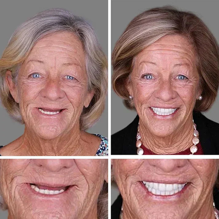 🏆2026 Bestselling Product🦷 Fit for a Fresh Smile, Say Goodbye to Wearing Discomfort!🌎