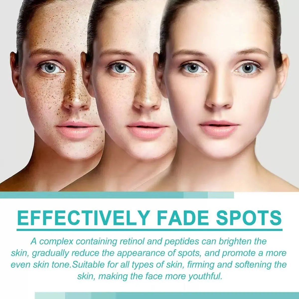 Dark Spot Corrector-Special Cream For Melasma Treatment