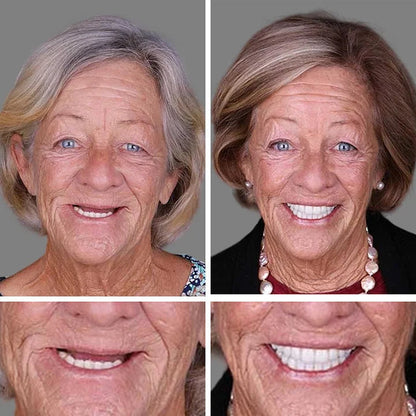 Ends Today: 70% OFF  Custom-Fit Full Functional Dentures