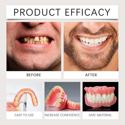 Smile Refine Tooth Reshaping & Gap Repair Kit