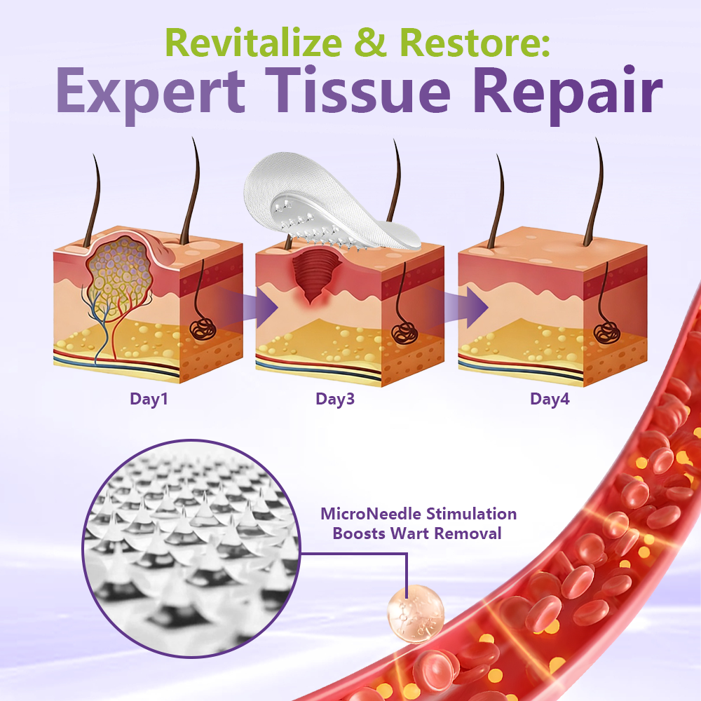 SOLUBLE MICRONEEDLE BOTANICAL SKIN TAG REMOVAL PATCH