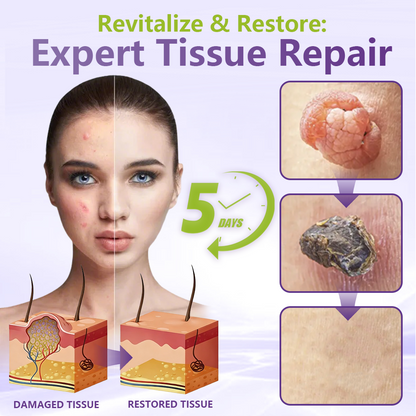 SOLUBLE MICRONEEDLE BOTANICAL SKIN TAG REMOVAL PATCH