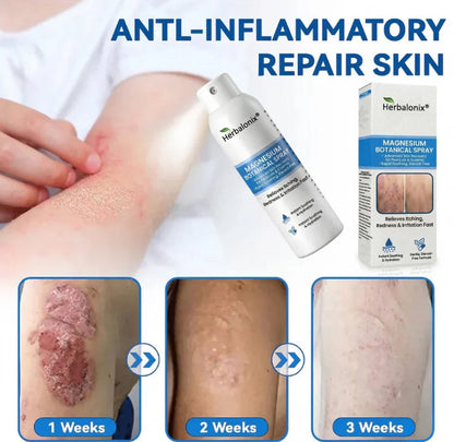 🔥Herbalonix® Magnesium Botanical Spray – Advanced Skin Recovery for Psoriasis & Eczema | Rapid Soothing, Steroid-Free