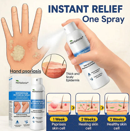 🔥Herbalonix® Magnesium Botanical Spray – Advanced Skin Recovery for Psoriasis & Eczema | Rapid Soothing, Steroid-Free
