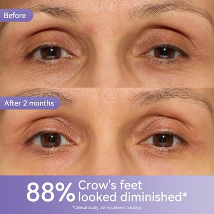 Retinol 0.1 Caffeine Revitalizing Eye Cream