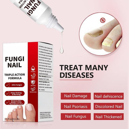 Toenail Fungus Treatment Extra Strengthr