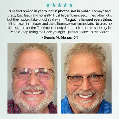 🌎Ending today: 30% off! ⏰ Medical-grade full dentures with strong suction.